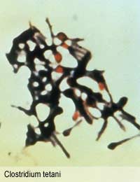 Tetanus Lockjaw Tetani Clostridium