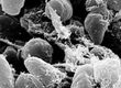 Which Bacterium Causes the Plague?