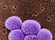 What Are Antibiotic Resistant Bacteria?