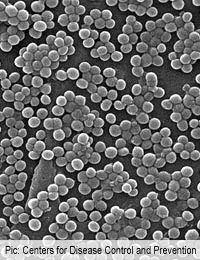 Mrsa Mrse Methicillin Resistance